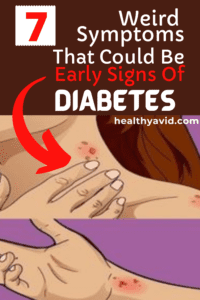 Early signs and symptoms of diabetes pinterest