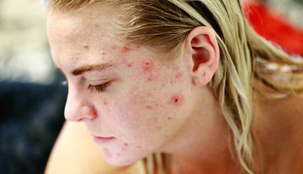 symptoms of diabetes skin problems