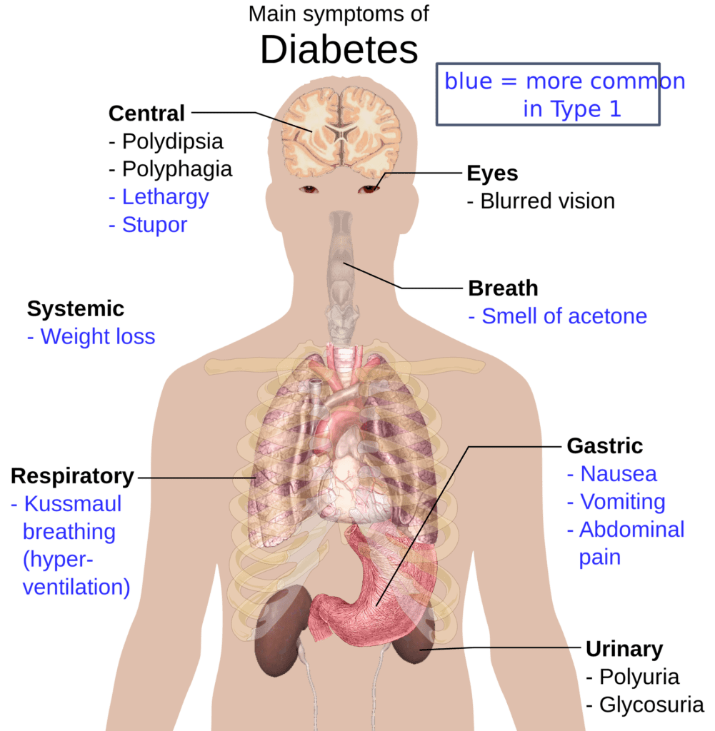 diabetes- symptoms of diabetes