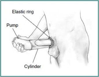 PENIS PUMP FOR ED