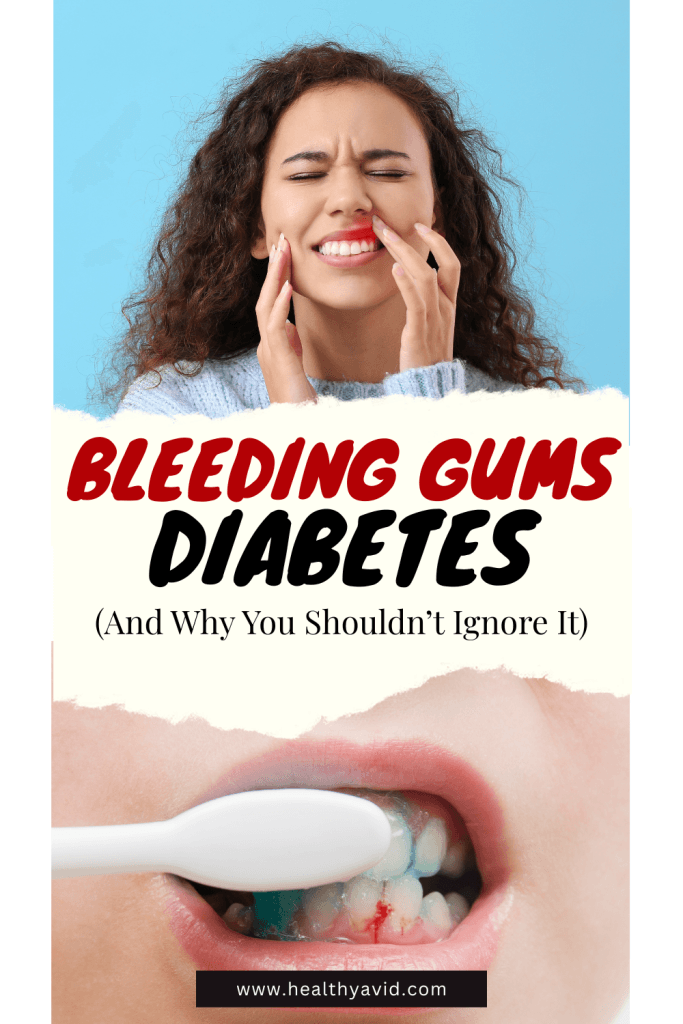 Bleeding Gums Diabetes symptoms -pinterest