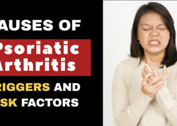 Causes of Psoriatic Arthritis_HEALTHYAVID.COM